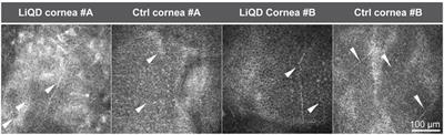 A Liquid Hydrogel to Restore Long Term Corneal Integrity After Perforating and Non-Perforating Trauma in Feline Eyes